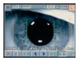 Tomey RC-5000 - Autorefractor Keratometer - Used 17 Captura de Pantalla 2026 02 23 a las 10.03.38 a. m