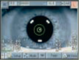 Tomey RC-5000 - Autorefractor Keratometer - Used 13 Captura de Pantalla 2026 02 23 a las 9.55.01 a. m