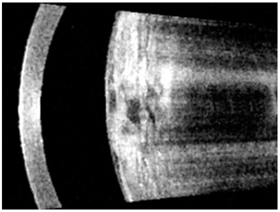 ZEISS IOLMaster - 700 - Refurbished 9 Zeiss IOLMaster 700 swept-source OCT — anterior segment and crystalline lens image