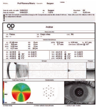 ZEISS IOLMaster - 700 - Refurbished 6 Zeiss IOLMaster 700 biometry printout — axial length, keratometry and OCT scan report