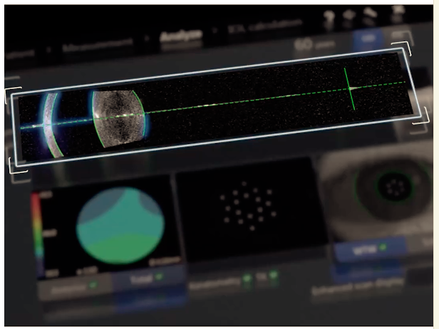 ZEISS IOLMaster - 700 - Refurbished 7 Zeiss IOLMaster 700 software screen — full-length eye OCT and keratometry analysis