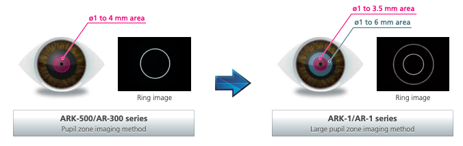 Nidek ARK-1 - Autorefractor Keratometer - Used 11 Captura de Pantalla 2026 03 30 a las 2.05.26 p. m