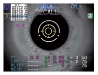 Nidek ARK-1 - Autorefractor Keratometer - Used 13 Captura de Pantalla 2026 03 30 a las 2.10.33 p. m