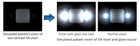 Nidek ARK-1 - Autorefractor Keratometer - Used 15 Captura de Pantalla 2026 03 30 a las 2.11.59 p. m