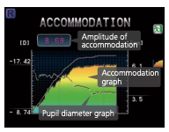 Nidek ARK-1 - Autorefractor Keratometer - Used 17 Captura de Pantalla 2026 03 30 a las 2.15.14 p. m