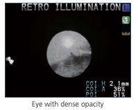Nidek ARK-1 - Autorefractor Keratometer - Used 20 Captura de Pantalla 2026 03 30 a las 2.21.32 p. m