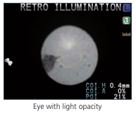 Nidek ARK-1 - Autorefractor Keratometer - Used 21 Captura de Pantalla 2026 03 30 a las 2.22.13 p. m
