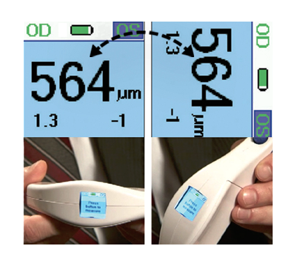 Reichert iPac Corneal Pachymeter Used 16 Reichert iPac corneal pachymeter used — portable design for clinic use
