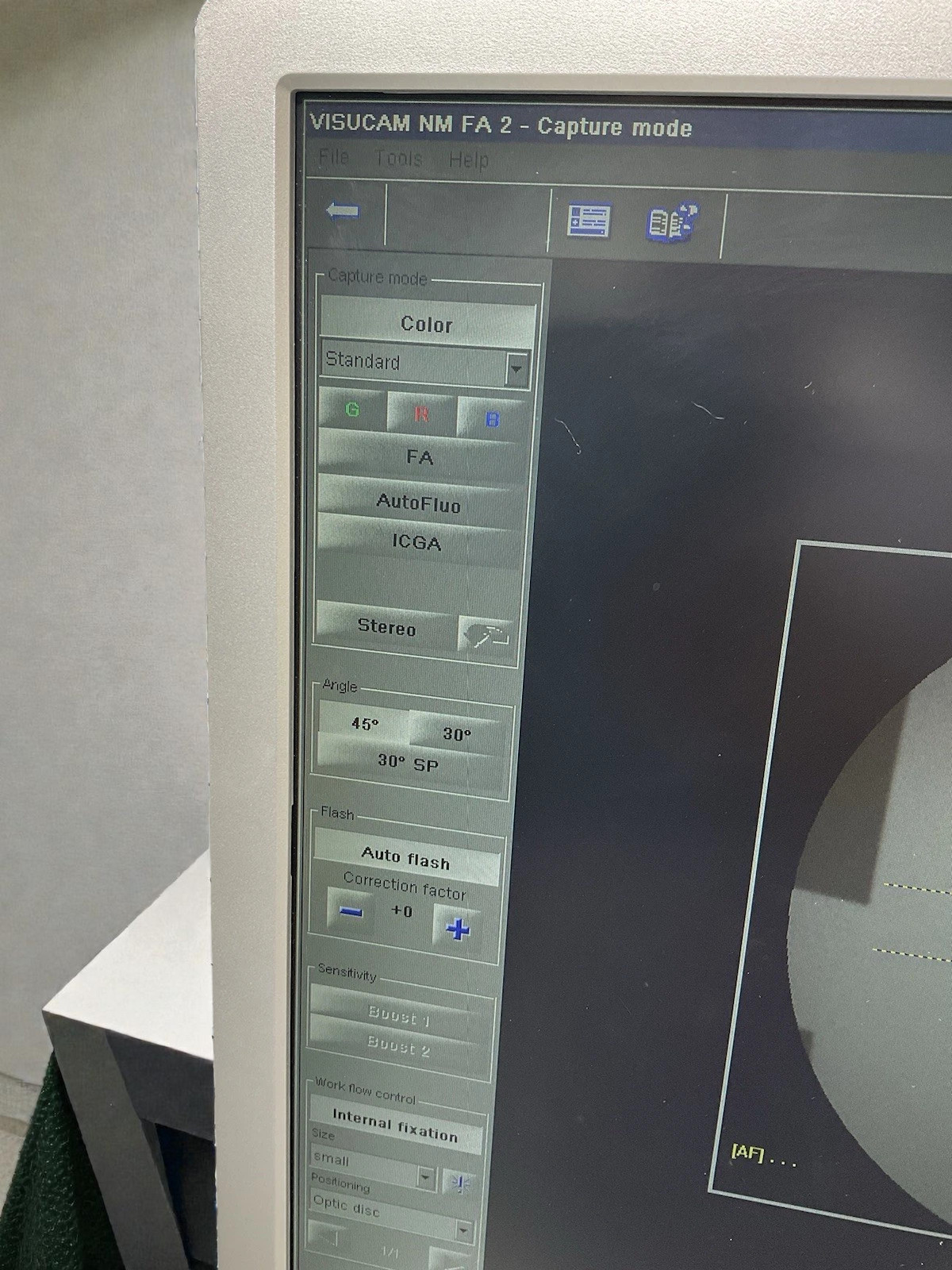 Zeiss Visucam PRO NMFA, FAF, ICG - Refurbished 5 Zeiss Visucam PRO NMFA, FAF, ICG - Refurbished - Image 5