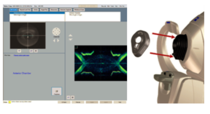 Zeiss Optional Anterior Segment Premier Lenses for Cirrus 4000, 500, 5000, 6000 - Refurbished 5 Zeiss Cirrus anterior segment scan workflow step overview