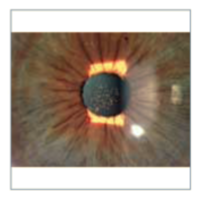 Haag Streit BD 900 Slit Lamp with Haag Streit AT900 Tonometer - Used 13 Haag-Streit BD 900 slit lamp contact lens fitting yellow filter features