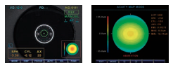 Reichert Package: RK 700 Auto Ref/ Keratometer, LensChek Pro, 7cr NCT - Used 25 Reichert RK-700 graphical display of refraction results