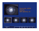 Reichert Package: RK 700 Auto Ref/ Keratometer, LensChek Pro, 7cr NCT - Used 29 Reichert RK-700 retro-illumination mode cataract screening