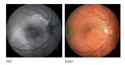 Carl Zeiss Visucam NM/ FA w/ Electric Table - Used 10 Captura de Pantalla 2026 04 21 a las 9.33.31 a. m