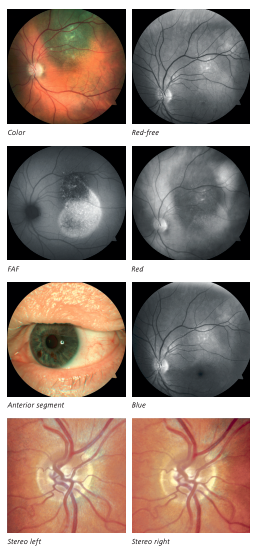 Carl Zeiss Visucam NM/ FA w/ Electric Table - Used 11 Captura de Pantalla 2026 04 21 a las 9.35.05 a. m