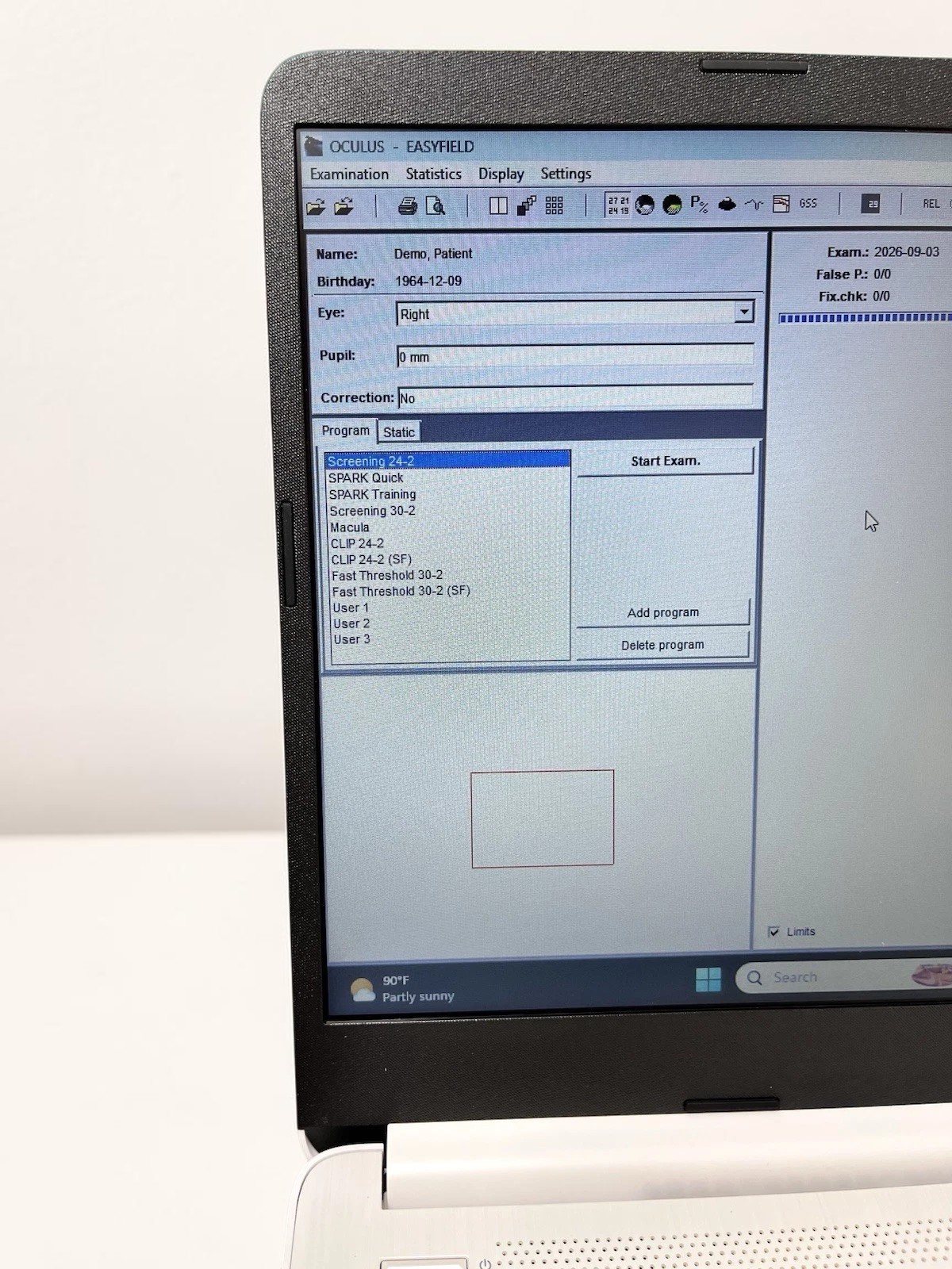 Oculus Easyfield C Visual Field Tester Analyzer w/ Laptop - Used 7 Oculus Easyfield C Visual Field Tester Analyzer w/ Laptop - Used – Detail View 6