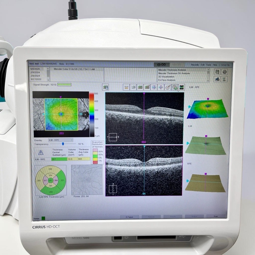 Carl Zeiss Cirrus 500 HD-OCT w/ Windows 10 - Used 4 Carl Zeiss Cirrus 500 HD-OCT w/ Windows 10 - Used - Image 4