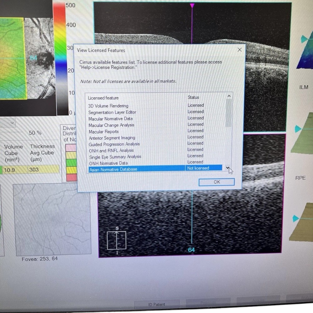 Carl Zeiss Cirrus 500 HD-OCT w/ Windows 10 - Used 5 Carl Zeiss Cirrus 500 HD-OCT w/ Windows 10 - Used - Image 5