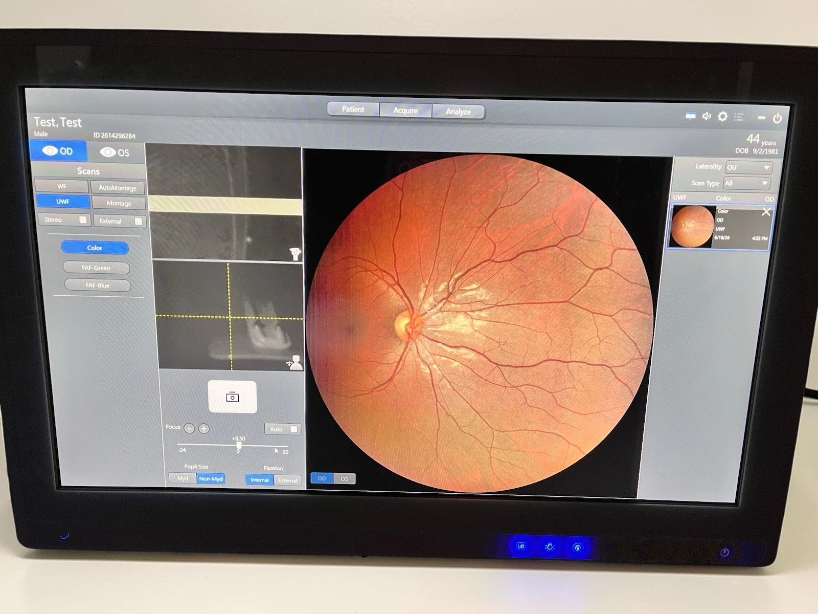 Carl Zeiss Clarus 500 Ultra-Widefield Fundus Camera w/ Windows 10 & FAF - Used 8 Carl Zeiss Clarus 500 Ultra-Widefield Fundus Camera w/ Windows 10 & FAF - Used - Image 8