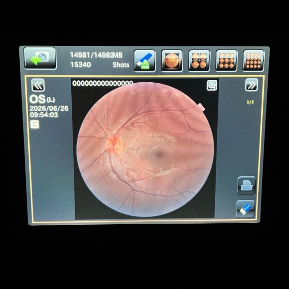 Topcon TRC-NW400 Non-Mydriatic Retinal Camera - Used 3 Topcon TRC-NW400 used — sample color fundus image on touch panel display