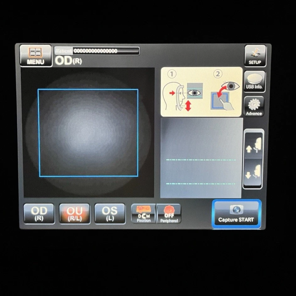 Topcon TRC-NW400 Non-Mydriatic Retinal Camera - Used 4 Topcon TRC-NW400 used — capture start screen on 10-inch touch panel