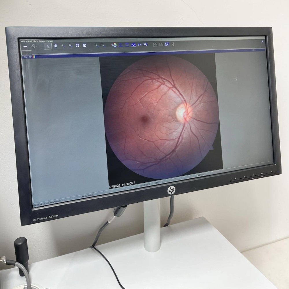 Zeiss Visucam 224 Non-Mydriatic Fundus Camera w/ Electric Table - Used 2 Zeiss Visucam 224 used — workstation monitor displaying a captured color retinal fundus image