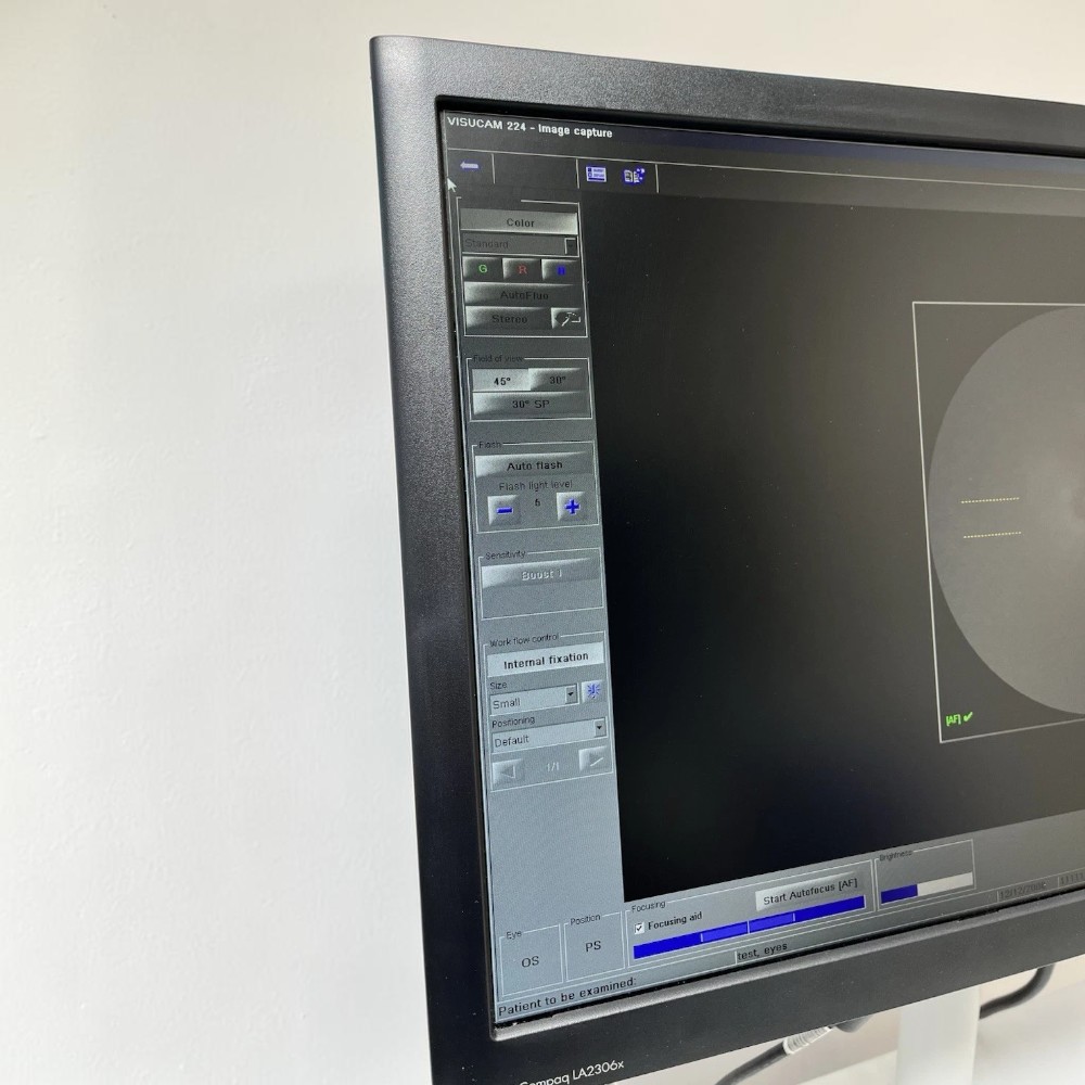 Zeiss Visucam 224 Non-Mydriatic Fundus Camera w/ Electric Table - Used 3 Zeiss Visucam 224 used — image-capture software alignment screen on the integrated workstation