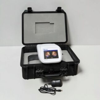Baxter/ Welch Allyn RetinaVue 700 Imager Handheld Retinal Camera w/ Case - Used