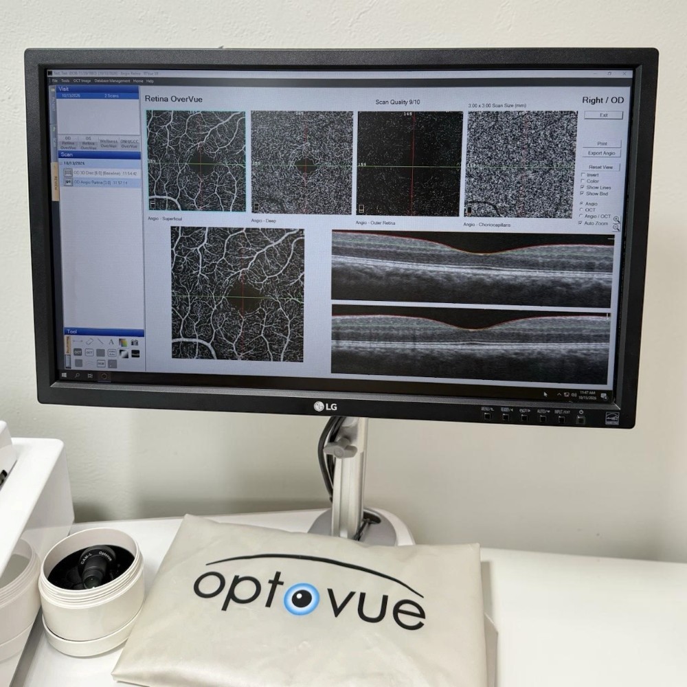 Optovue AngioVue Imaging System OCTA - Used 4 Optovue AngioVue Imaging System OCTA - Used - Image 4