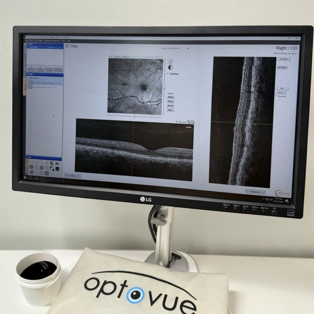 Optovue AngioVue Imaging System OCTA - Used 5 Optovue AngioVue Imaging System OCTA - Used - Image 5