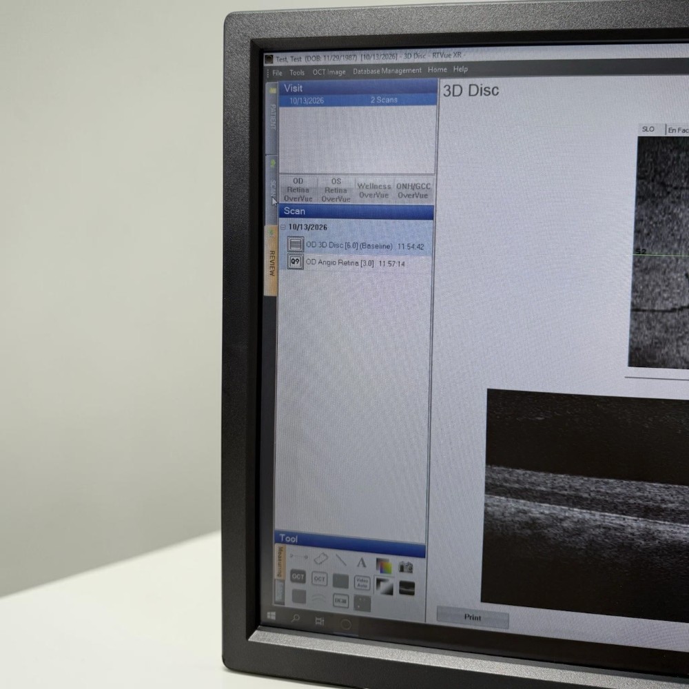 Optovue AngioVue Imaging System OCTA - Used 7 Optovue AngioVue Imaging System OCTA - Used - Image 7